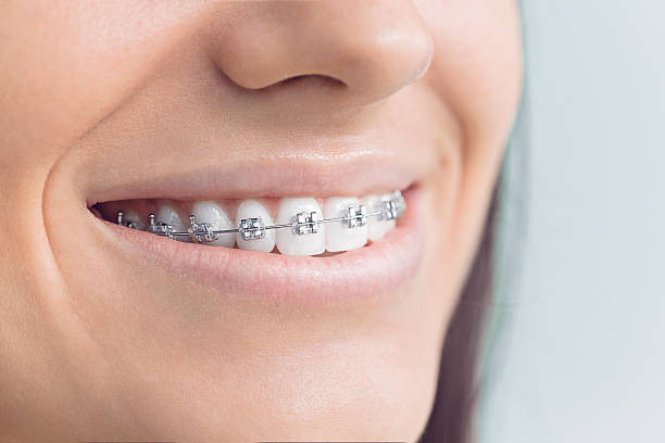 Best Dental Fillings (Composite and Amalgam)  in Carrollton, IL